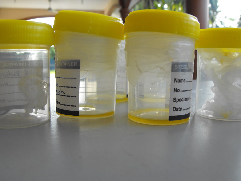Misconceptions About Antivenom Availability